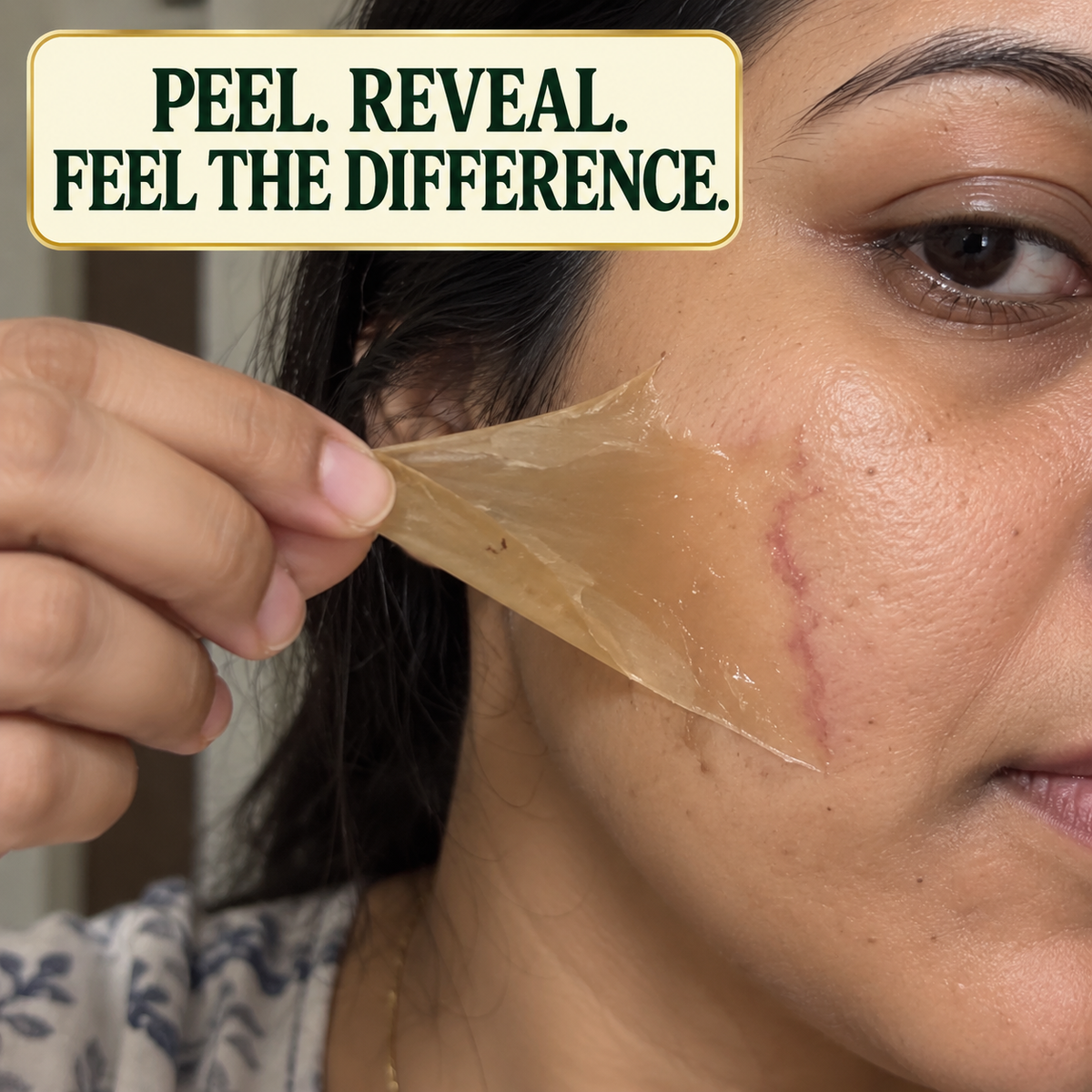 ScarGone - Scar Removal Peel Off Mask